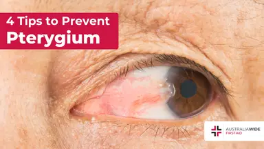 Prevent pterygium article header – First Aid Article in Richmond